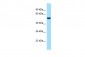 CDK5RAP3 antibody - N-terminal region