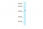 DUSP9 antibody - middle region