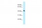 ENTPD5 antibody - N-terminal region