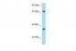 CCRL1 antibody - C-terminal region