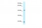 TPD52L2 antibody - C-terminal region