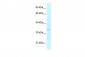 GOLPH3 antibody - middle region