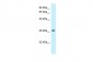 RPS4Y1 antibody - C-terminal region