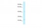 MRPL40 antibody - middle region