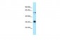 TMX1 antibody - C-terminal region