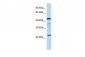 AVPR1B antibody - C-terminal region