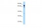 RARS antibody - C-terminal region