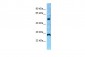 IL13RA1 Antibody - N-terminal region