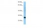 HLA-DRB3 antibody - C-terminal region