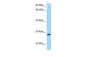 CD37 antibody - middle region