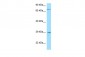 TNFRSF13B antibody - N-terminal region