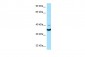 NCR1 antibody - N-terminal region