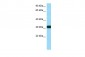 RPS3 antibody - C-terminal region