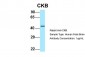 CKB antibody - C-terminal region