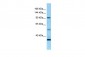 ROR1 antibody - N-terminal region