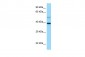 STRA8 antibody - C-terminal region