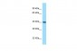 NOXO1 antibody - middle region