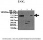 SNX1 antibody - N-terminal region