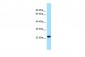 RPL19 antibody - C-terminal region