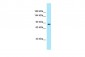 DMGDH antibody - C-terminal region