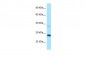 CTDSP1 Antibody - N-terminal region