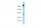 FKBP10 antibody - N-terminal region