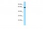 DPYSL4 antibody - C-terminal region