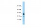 IL22RA2 Antibody - C-terminal region