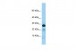 IL22RA2 Antibody - C-terminal region