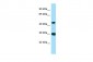 ACTG2 Antibody - C-terminal region