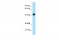 ARPC1B Antibody - C-terminal region