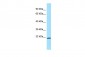 MRPL12 Antibody - middle region