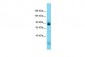 Nefm Antibody - C-terminal region