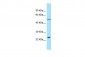 RAB30 Antibody - C-terminal region