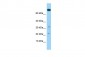 COASY Antibody - C-terminal region