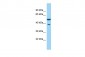 CORO1C Antibody - C-terminal region