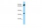 PSMB11 Antibody - C-terminal region