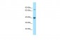 PPM1L Antibody - middle region