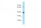 PPM1L Antibody - middle region