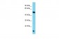 TOR4A Antibody - C-terminal region