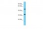 C6orf211 Antibody - N-terminal region