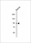 GSN Antibody (N-term)