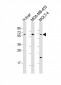 OPN-a/b Antibody (N-term)