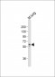 TGFBR2 Antibody (N-term)