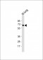 TGFBR2 Antibody (N-term)