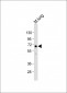 TGFBR2 Antibody (N-term)