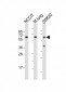 TGFBR2 Antibody (N-term)