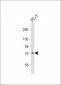 DVL1 Antibody (Center)