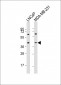 LGALS8 Antibody (C-term)