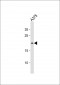 CDKN2A Antibody(N-term S8)